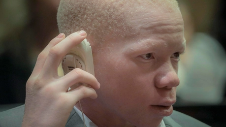 Mwigulu Matonange, der mit Albinismus lebt, hört einem Beitrag der UN-Konferenz über Albinismus / © Bebeto Matthews (dpa)